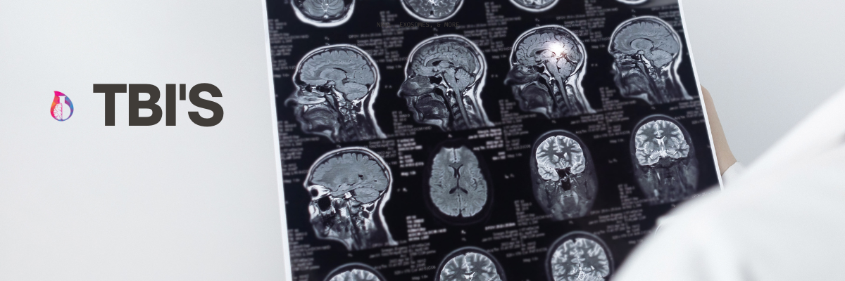 traumatic brain injuries and NAD+ therapy near me in bali